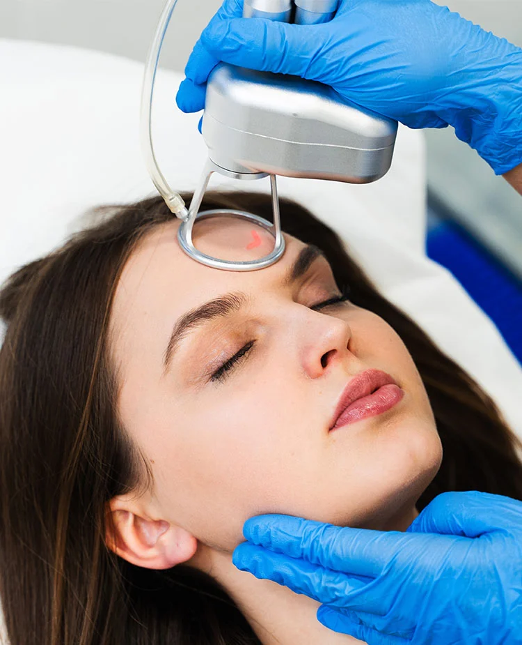 co2-laser-resurfacing-best-candidate