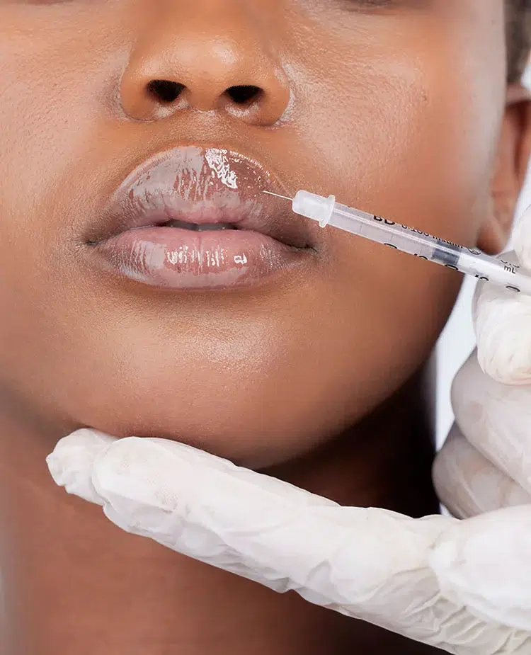 1759528475_lip-fillers-best-candidate Lip Fillers In Verona, NJ & Rutherford, NJ | Geria Dermatology