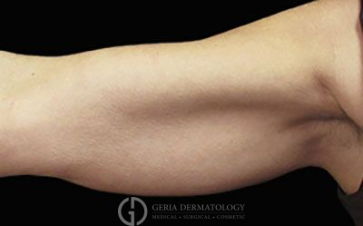 Before Image: Patient Case #2760 - front