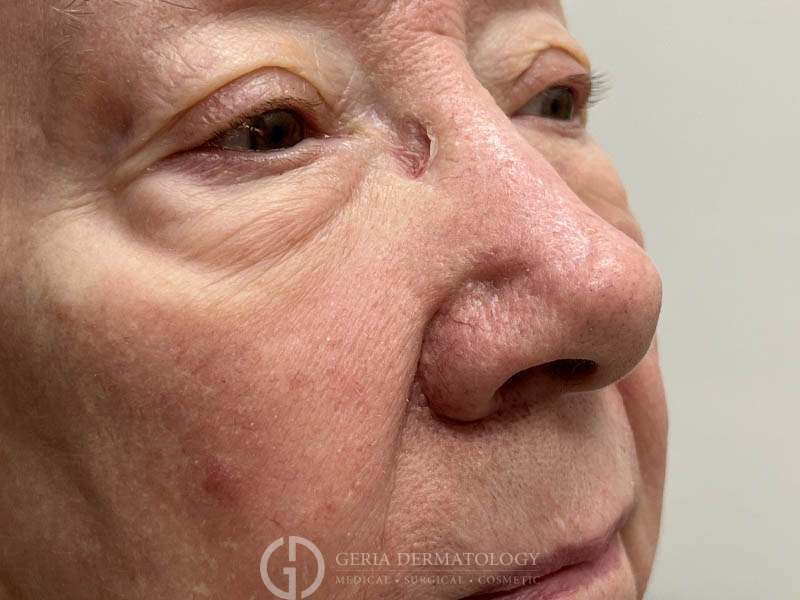 After Image: Patient Case #48101 - right-front-oblique