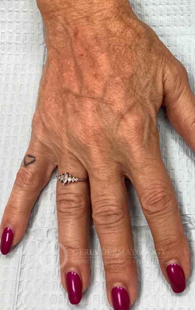 After Image: Patient Case #15918 - front