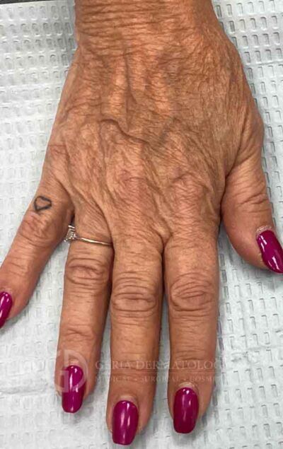 Before Image: Patient Case #15918 - front