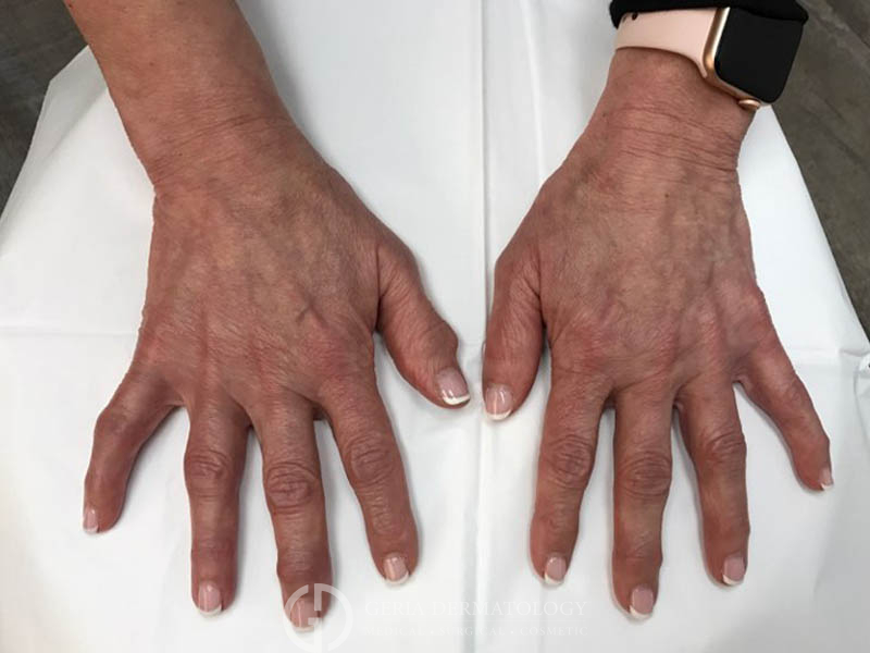 After Image: Patient Case #48059 - front