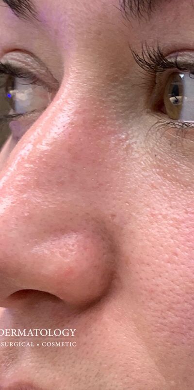 After Image: Patient Case #258 - left-front-oblique