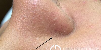 Before Image: Patient Case #260 - right-front-oblique