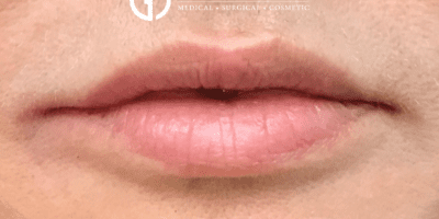 After Image: Patient Case #2935 - front