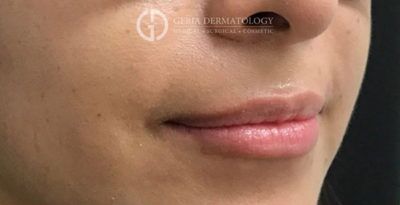 Before Image: Patient Case #5291 - right-front-oblique