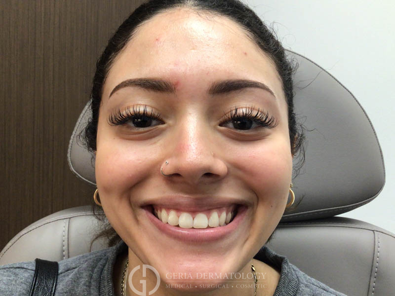 After Image: Patient Case #48068 - front