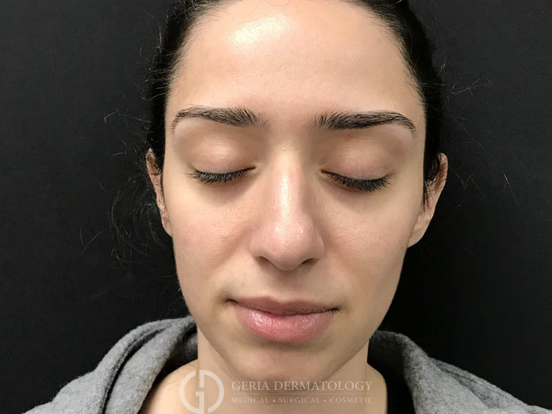 After Image: Patient Case #48077 - front