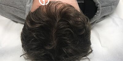 After Image: Patient Case #1726 - back