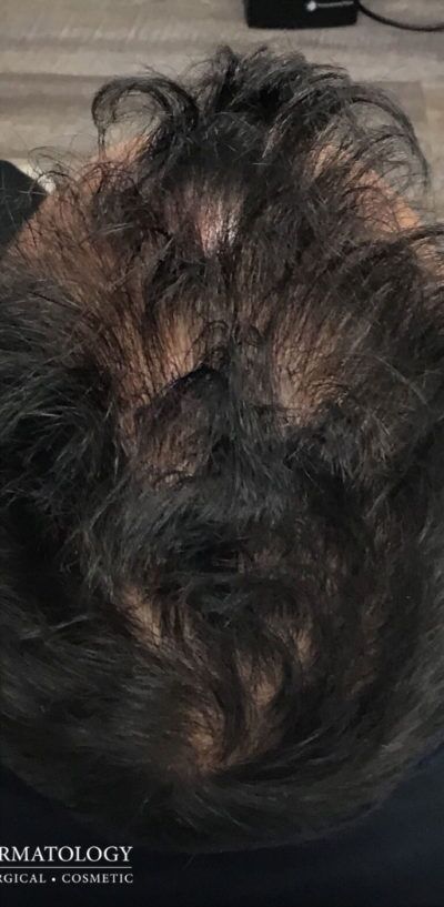 After Image: Patient Case #2861 - back