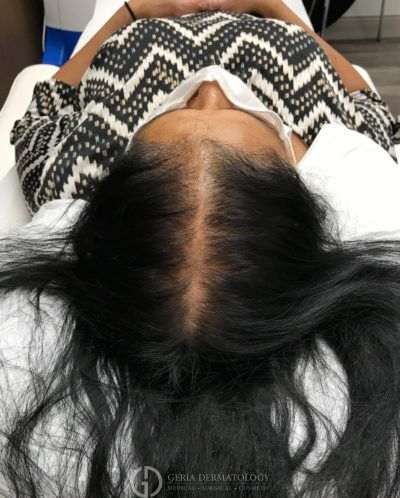 After Image: Patient Case #5588 - back