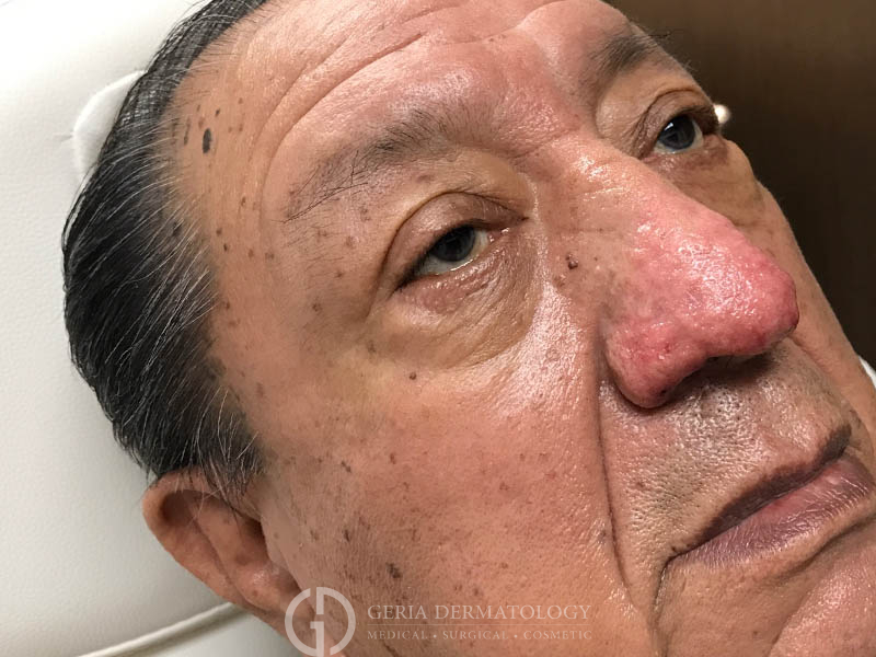 After Image: Patient Case #48095 - right-front-oblique