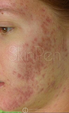 Before Image: Patient Case #8352 - left-front-oblique