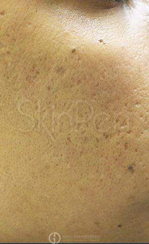 After Image: Patient Case #8353 - right-front-oblique