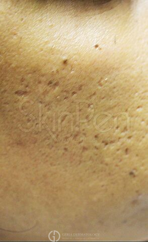 Before Image: Patient Case #8353 - right-front-oblique