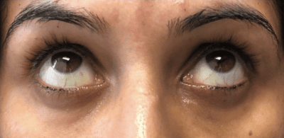 After Image: Patient Case #2995 - front