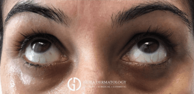 Before Image: Patient Case #2995 - front