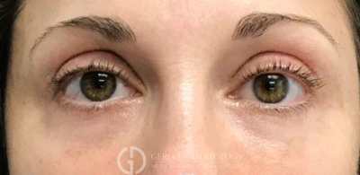 After Image: Patient Case #5583 - front