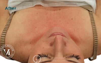 After Image: Patient Case #5992 - front