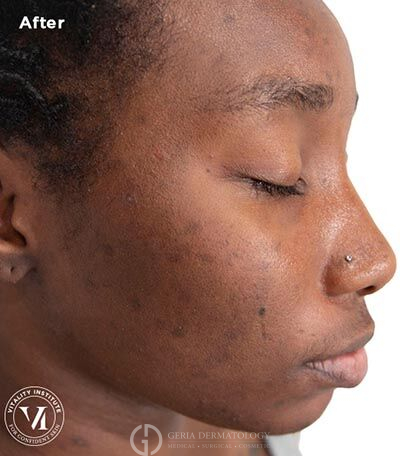 After Image: Patient Case #5995 - right-side