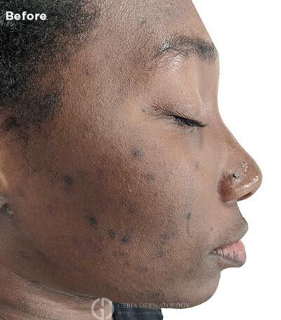 Before Image: Patient Case #5995 - right-side