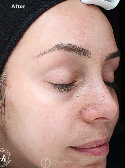 After Image: Patient Case #6003 - right-front-oblique