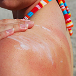 5 best products to soothe sunburn