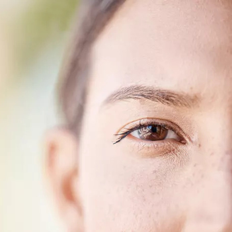 Got-Eyebrow-Dandruff