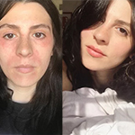 skin-barrier-protection