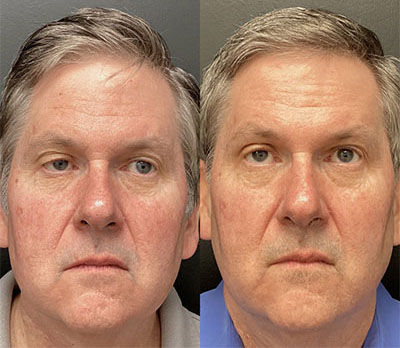 this-is-60 | Geria dermatology