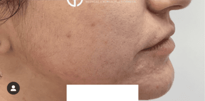 After Image: Patient Case #2959 - right-side