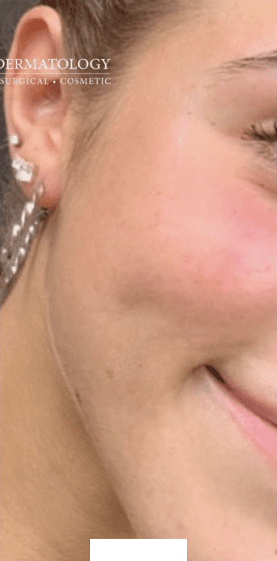 After Image: Patient Case #2960 - right-front-oblique