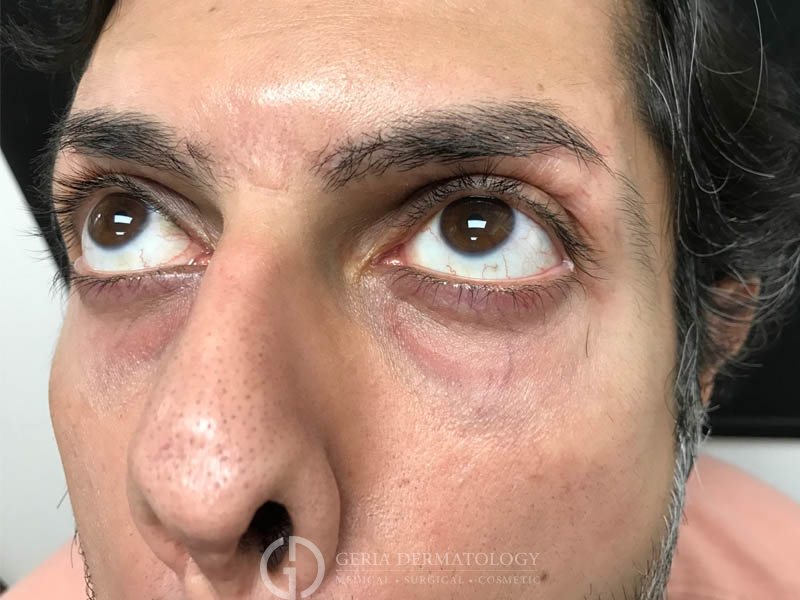 Before Image: Patient Case #48083 - left-front-oblique