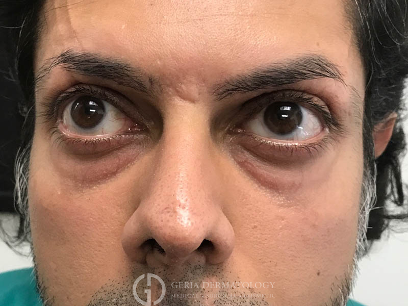 After Image: Patient Case #48083 - left-front-oblique