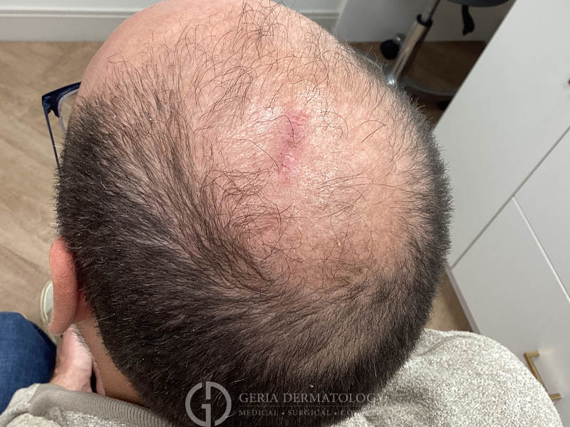 After Image: Patient Case #48050 - left-back-oblique