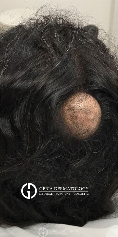 Before Image: Patient Case #4080 - left-back-oblique