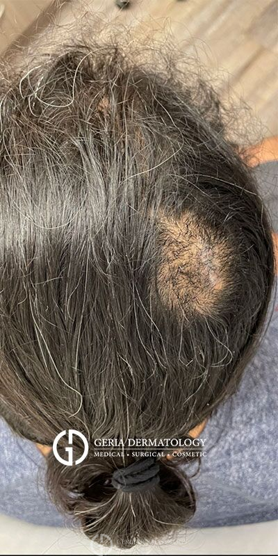 After Image: Patient Case #4080 - left-back-oblique