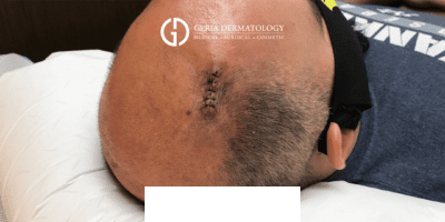 After Image: Patient Case #2974 - right-back-oblique