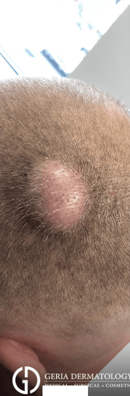 Before Image: Patient Case #2973 - left-back-oblique