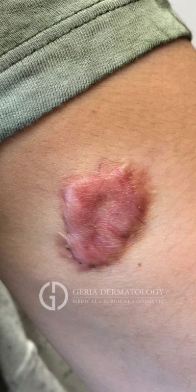 Before Image: Patient Case #7071 - right-front-oblique