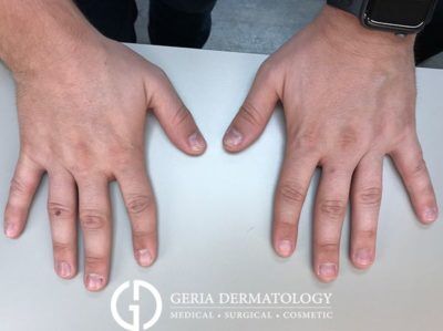 After Image: Patient Case #5111 - front