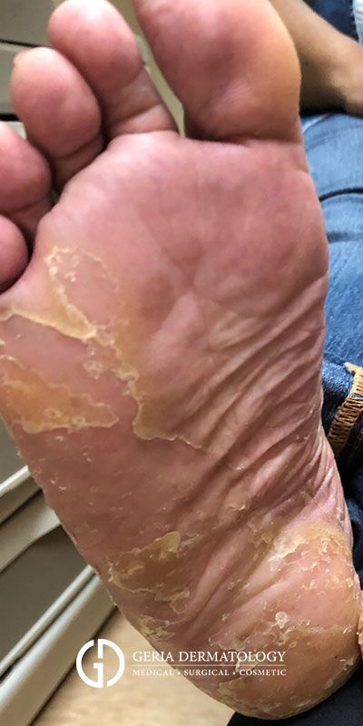 Before Image: Patient Case #4083 - front