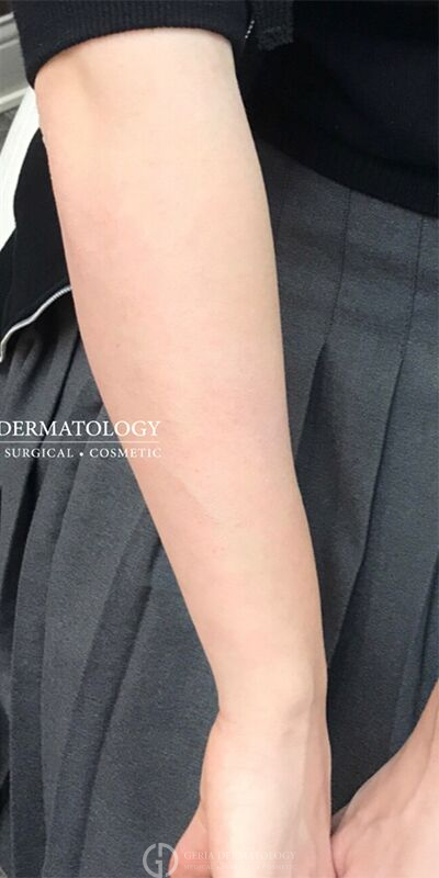 After Image: Patient Case #1731 - front