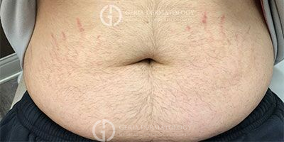 After Image: Patient Case #3963 - front