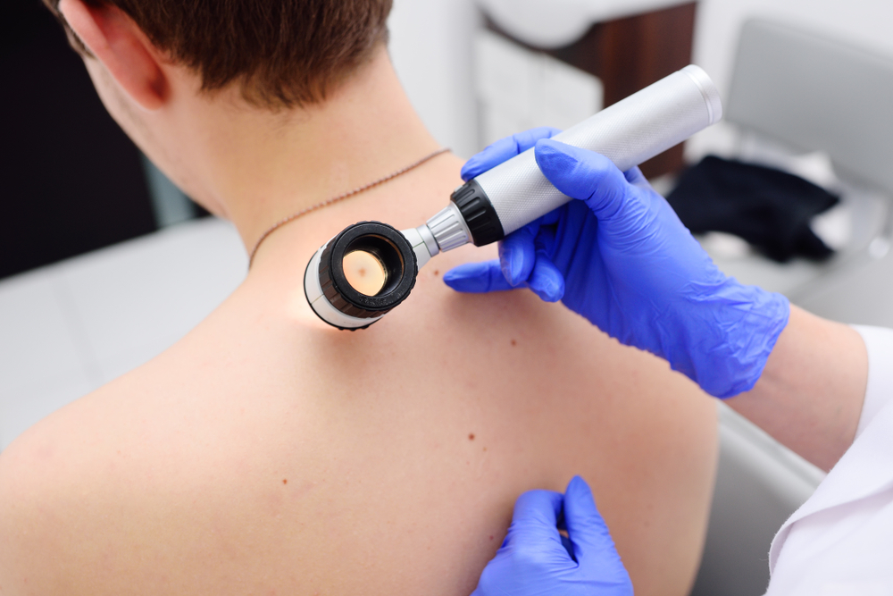A dermatologist examining a patient's back during a skin cancer screening A dermatologist examining a patient's back during a skin cancer screening