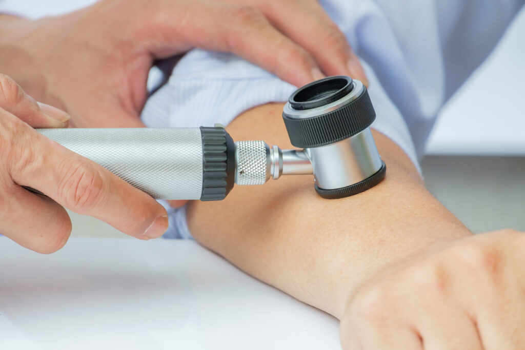 Dermatologist,Examines,Child,Patient,Birthmark,With,Dermatoscope.,Mole,Checkup.,Professional Melanoma Treatment In Rutherford, New Jersey
