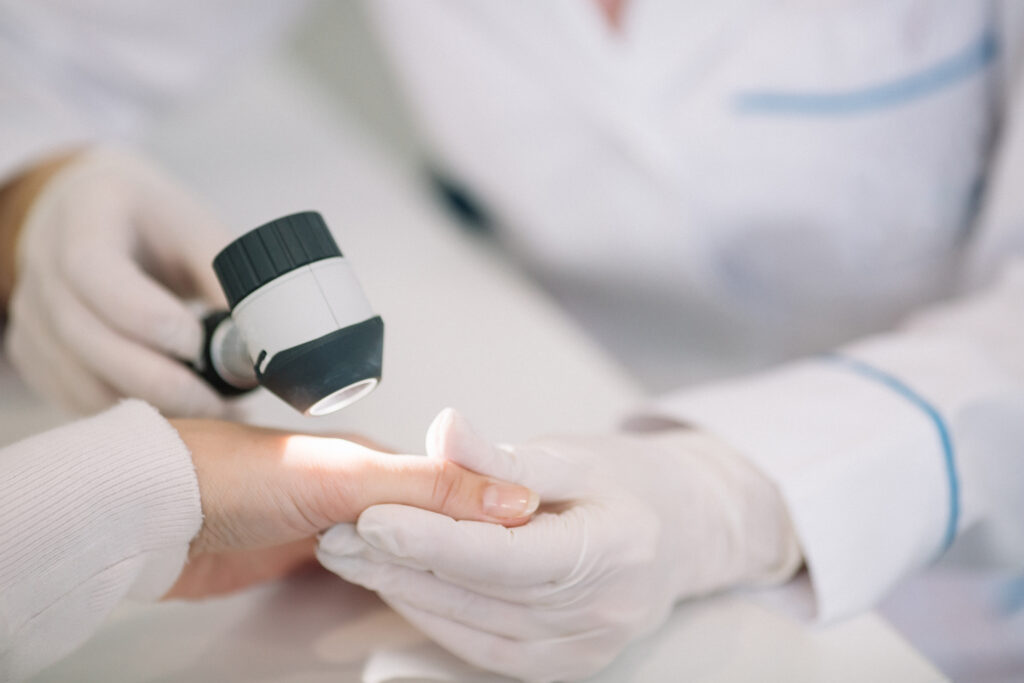 Closeup,Of,Dermatologist,Examining,Mole,On,Hand,Of,Female,Patient Lumps & Bumps Treatment In Rutherford, New Jersey