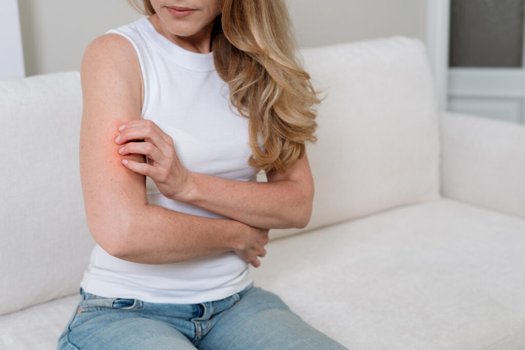A woman with psoriasis scratching her arm A woman with psoriasis scratching her arm