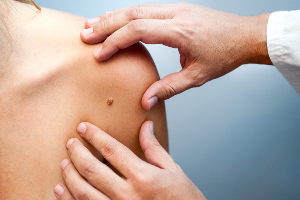 Dermatologist Near Me In Rutherford & Verona | Geria Dermatology in NJ